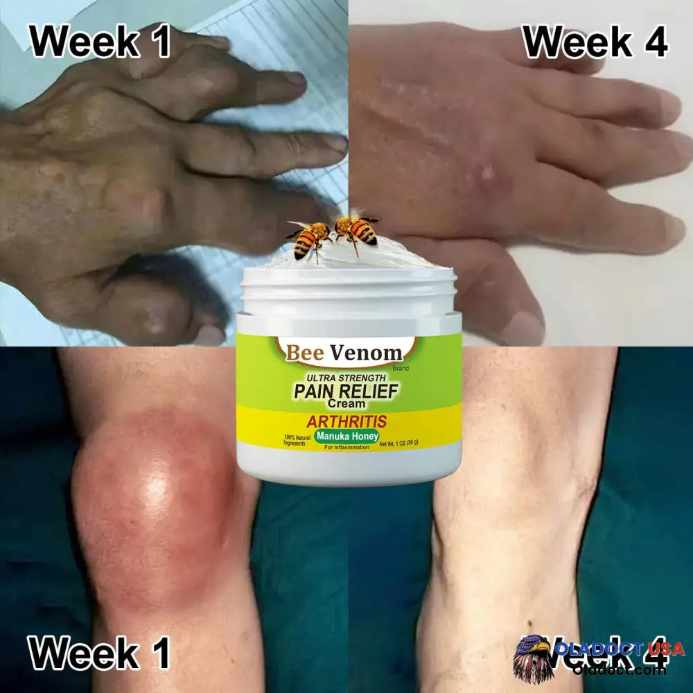 New Zealand Bee Venom Joint And Bone Therapy Advanced Cream