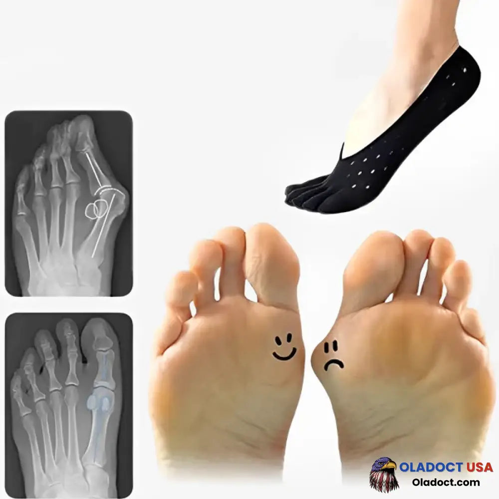 Bunion Corrective Toe Socks