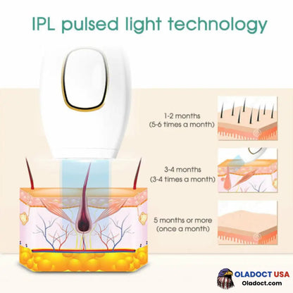 Sale - Ipl Laser Hair Removal